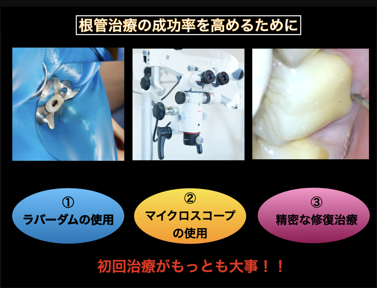 根管治療は最初が肝心🦷 | 渡辺歯科医院 加古川市志方町の歯医者